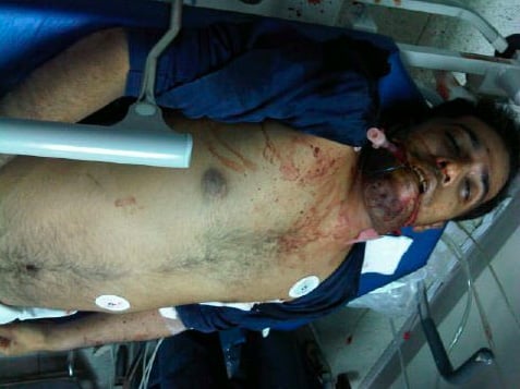 The body of Ali Abdulhadi Mushaima