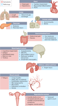 | Image taken from the Nature Paper Long COVID major findings mechanisms and recommendations Presented by Davis et al | MR Online