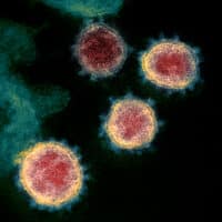 This colorized transmission electron microscope image shows SARS-CoV-2—also known as 2019-nCoV, the virus that causes COVID-19.