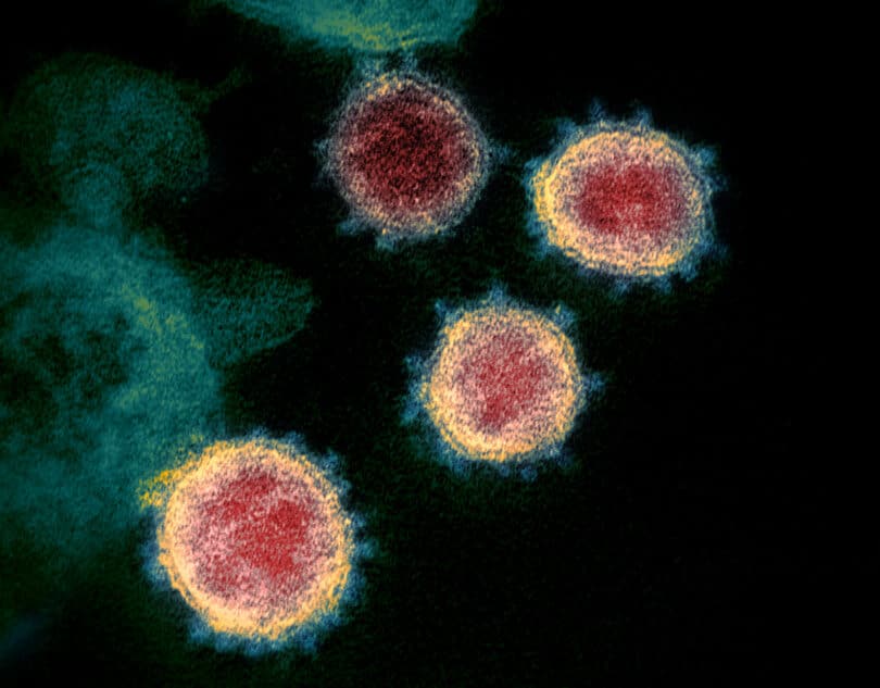  | This colorized transmission electron microscope image shows SARS CoV 2also known as 2019 nCoV the virus that causes COVID 19 | MR Online