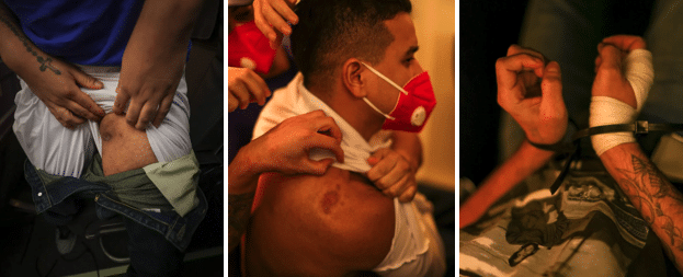 Screenshot 20250720 at 84257 PM | MR Online Images of the mistreatment suffered by kidnapped migrants in El Salvadors maximum security prison Photos Con el Mazo Dando